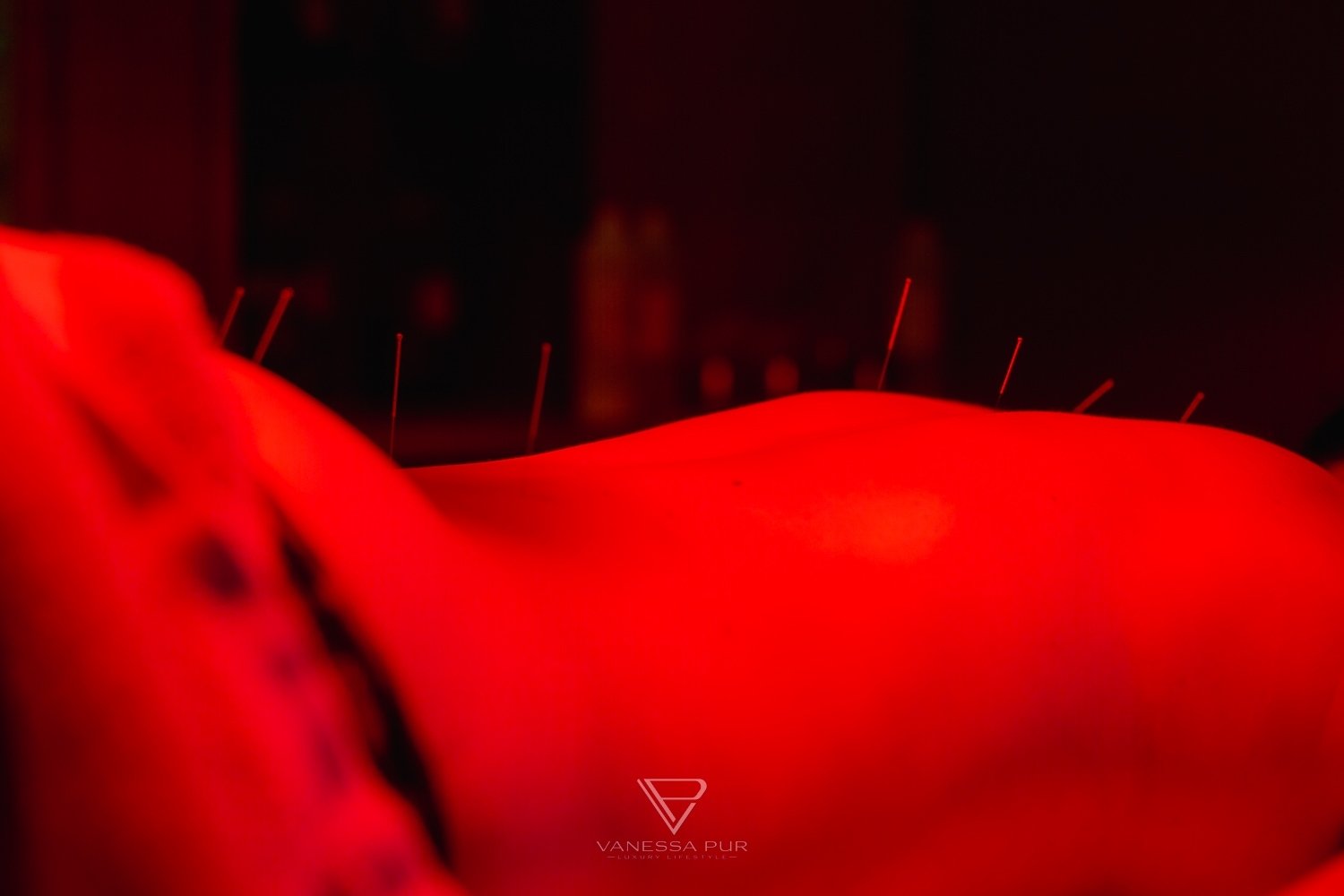 Akupunktur im St. Regis Mardavall Mallorca Luxus Wellness - Wellness auf Mallorca - traditionelle Chinesische Medizin - Erholung im St. Regis Mardavall